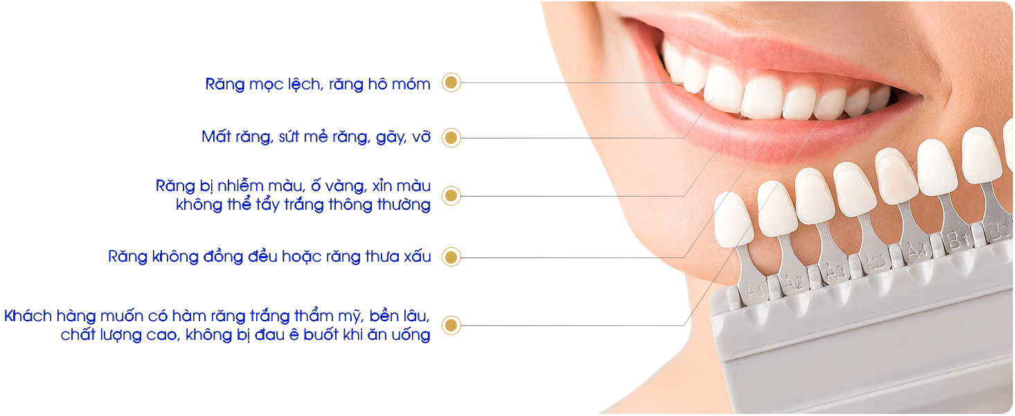 Khi nào sử dụng 